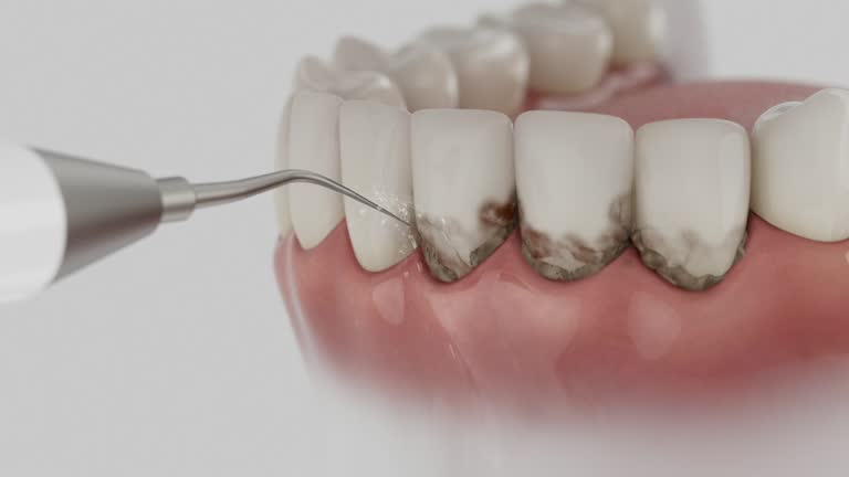 Reliable Dental contractor in Tipton, IN by Dentist Open Now